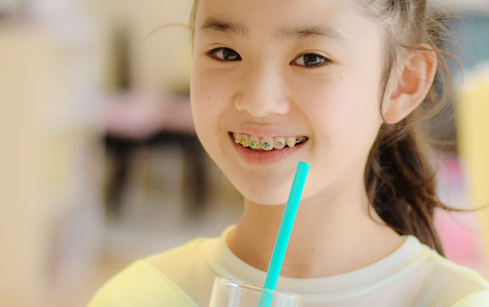 きれいな歯並びをつくるお子様のための矯正