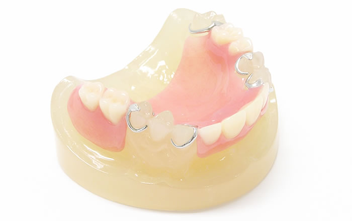 歯科治療後の口内環境の変化