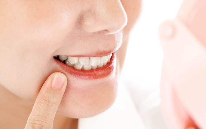 ホワイトスポットとは