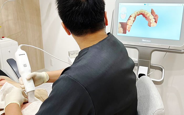 インビザラインの歯の移動量,治療前にコンピューターシミュレーションを行い、歯の移動距離や移動方向を解析します