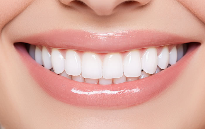 スマイルラインが前歯にどのように重なるのかも審美性を左右します