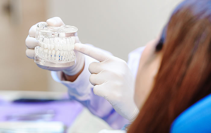 町田歯科では、約半数の方がフラップレスのインプラント治療を受診