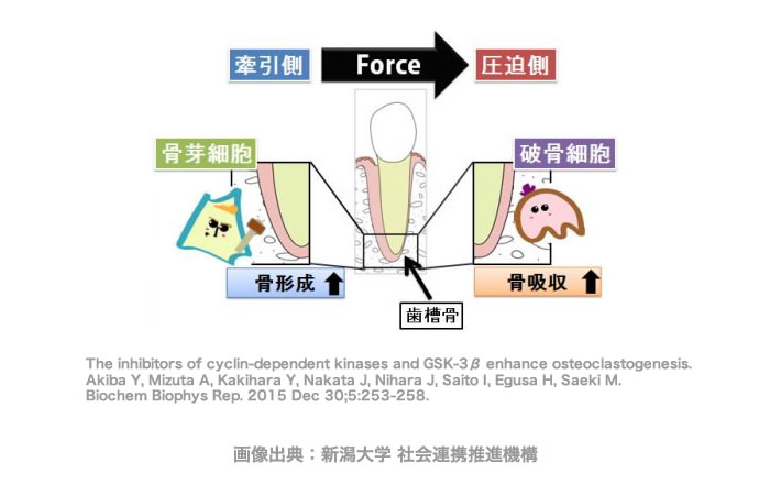 歯が動く仕組み～破骨細胞と骨芽細胞