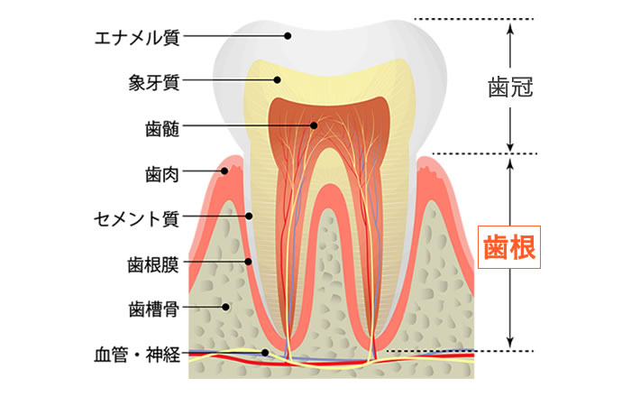 歯根が残っているか、残っていないか