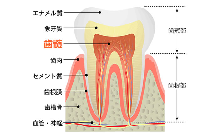 歯の痛みのほとんどは、前述の生理的疼痛に分類されます。虫歯などが原因となって、歯髄（しずい：歯の神経）に刺激が加わることで生じます。