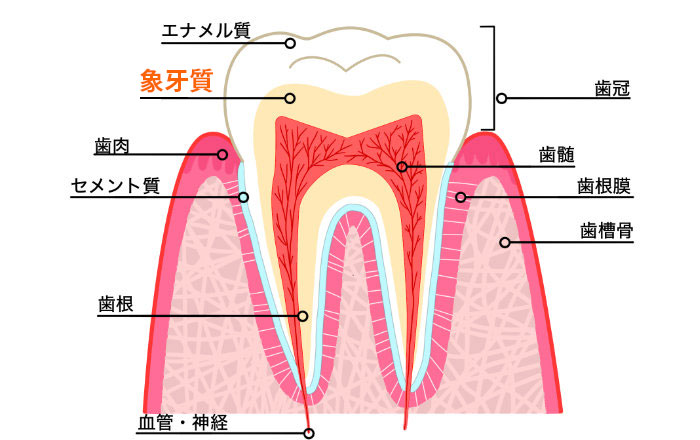 歯の痛みの主な原因は象牙質への刺激