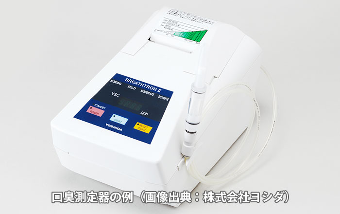 口臭外来での検査・診断