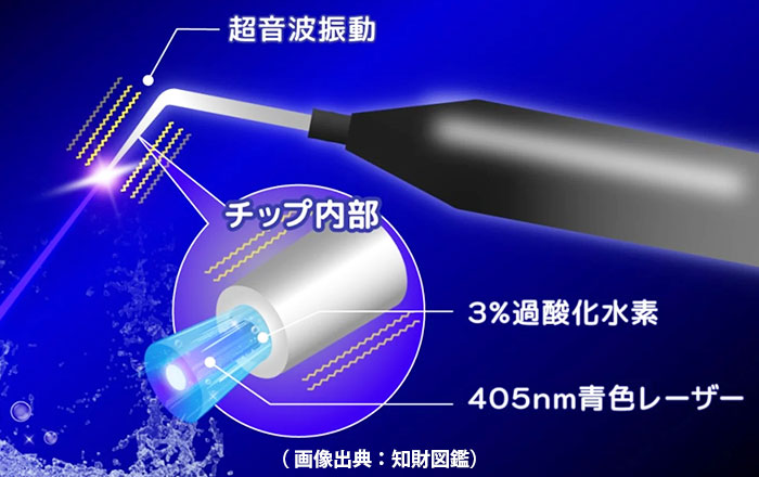 3％の過酸化水素水に405ナノメートルの青色レーザー光を照射することで、強力な殺菌力を持つヒドロキシルラジカル（・OH）を生成し、わずか2分で歯周ポケット内の歯周病菌を99.9％殺菌します。