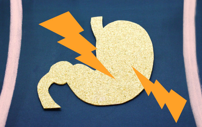 胃食道逆流症（GERD）とは