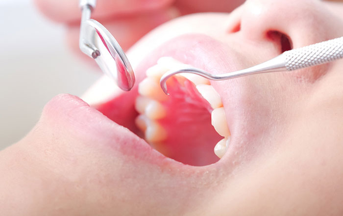 ダイアグノデントペンのメリット：痛みや不快感がほとんどない