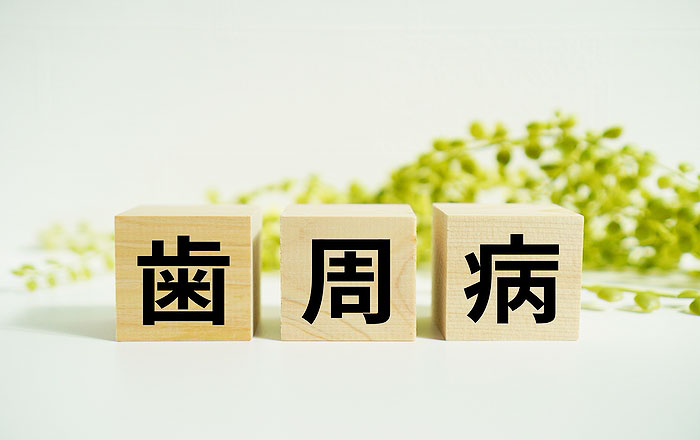 虫歯がない人こそ歯周病に気づきにくい理由：歯周病は痛みが出にくい