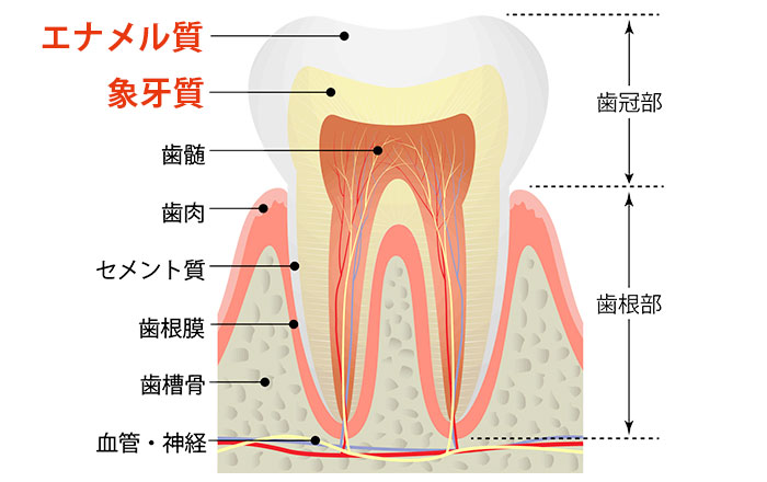ホワイトニング後にしま模様が現れる原因：エナメル質の厚みの違い