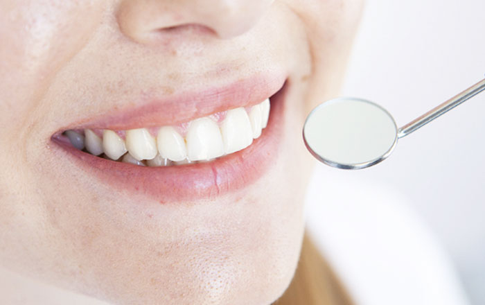 歯のクリーニングのおすすめの頻度：虫歯や歯周病がなく健康なお口の方は4〜6ヶ月に1回