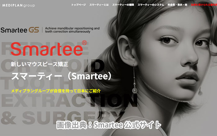 スマーティー矯正とは