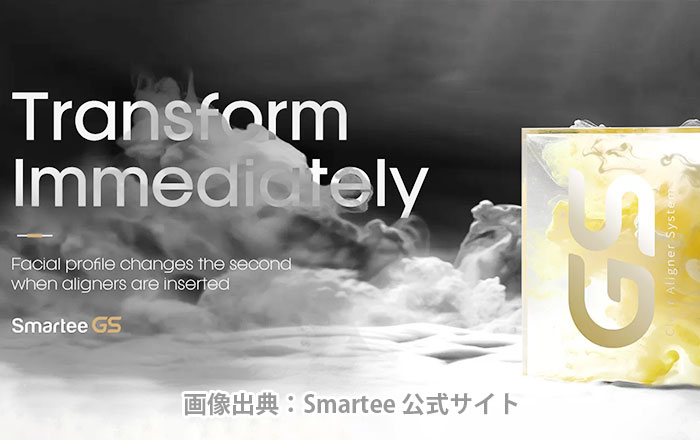 Smartee GS(スマーティー ジーエス)