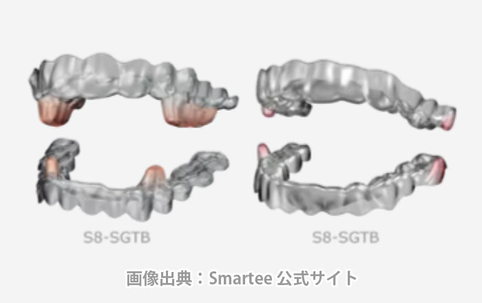スマーティー矯正のメリット:顎の位置を調整するアプローチができる