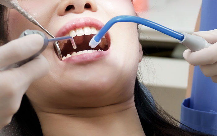 バキュームの役割 ④ 患者さんの「水が溜まって苦しい」を軽減