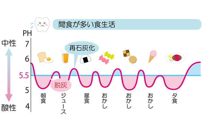 脱灰と再石灰化