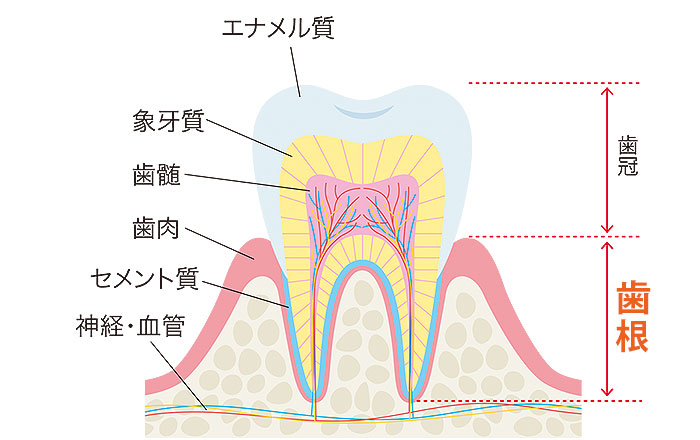 自力で歯並びを動かす5つのリスク：歯根が溶ける