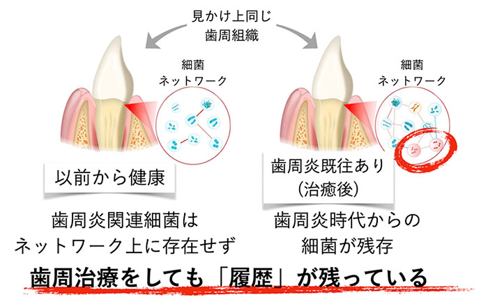 研究で分かってきた「炎症の履歴」